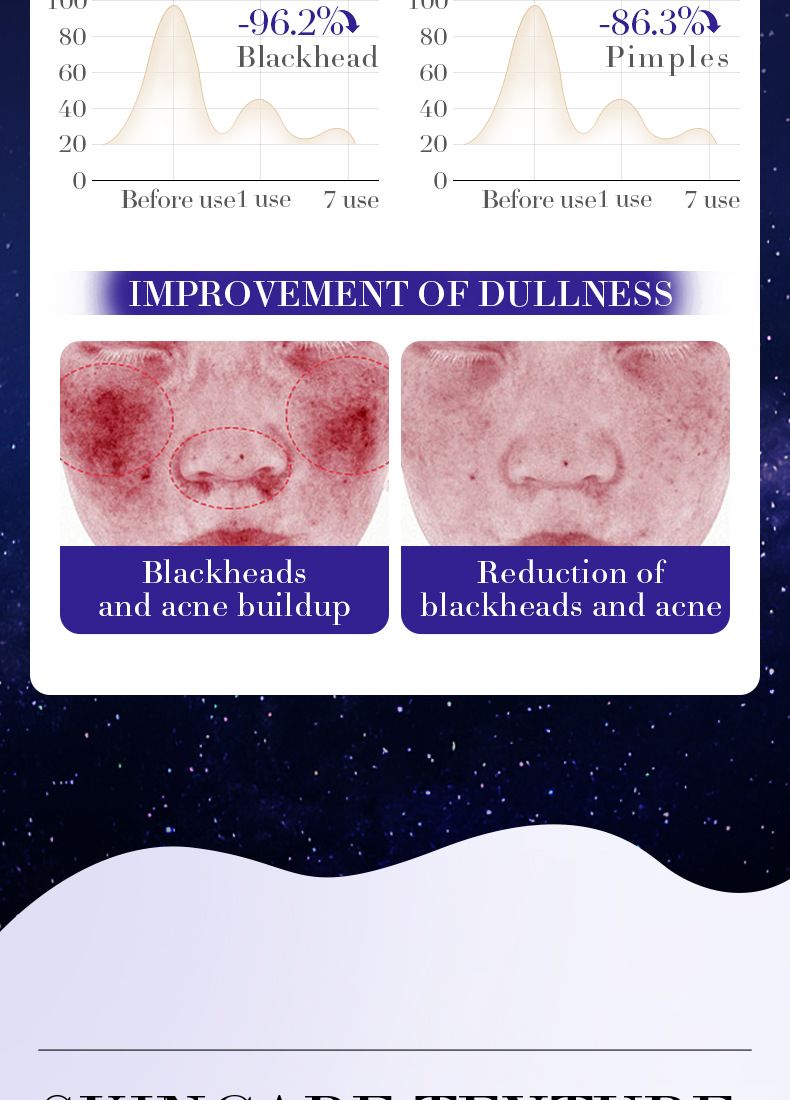 Mascarilla SADOER Starry Sky Whitening Cleansing Tear Mask, Elimina eficazmente los puntos negros, hidrata y rejuvenece, calma y repara la tirantez._voghion.com
