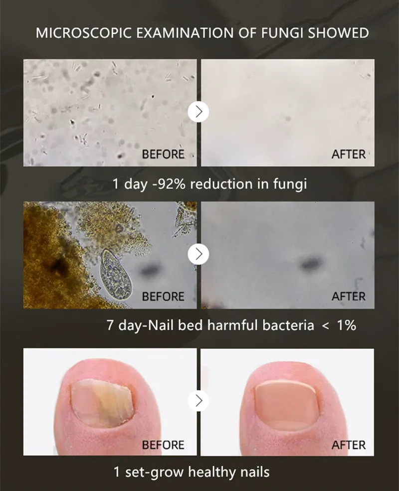 Essence de soin et de réparation des ongles à base de plantes, crème pour les ongles végétales_voghion.com