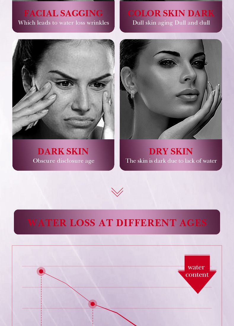 SADOER Niacinamide Whitening And Freckle Removal Serum, Hydrating And Moisturizing Pores_voghion.com