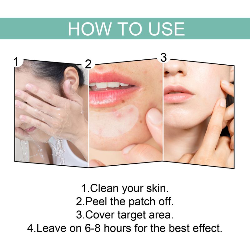 EELHOE Acne Patch Mild Non-Irritating Facial Pores Skin Cleansing Comfort Patch_voghion.com