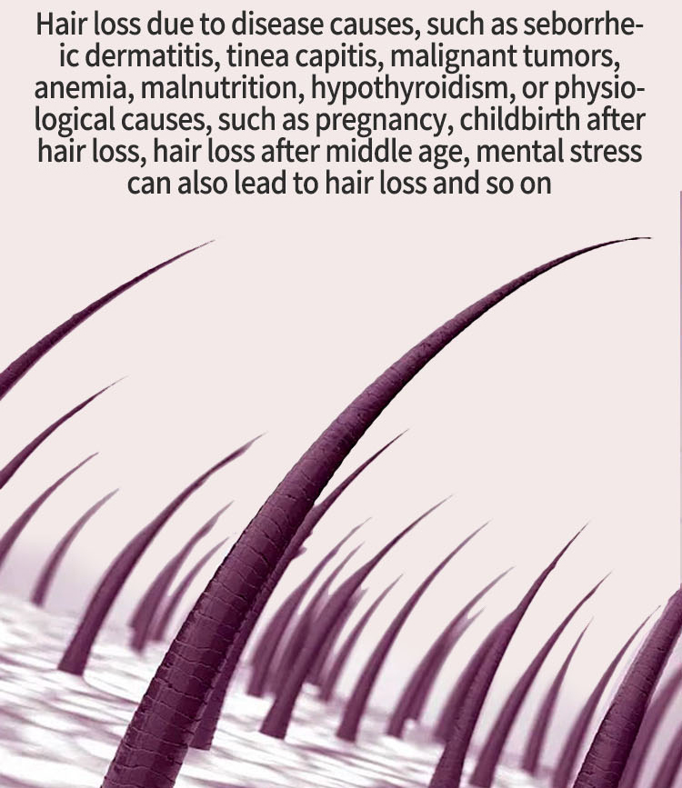 Biotin Fast 2023 Hoer Wuesstem Ueleg Hoer Wuesstem Serum Hoer Ausdünnung Behandlung Hoer Wuesstem Flëssegket Anti-Hoer Verloscht_voghion.com