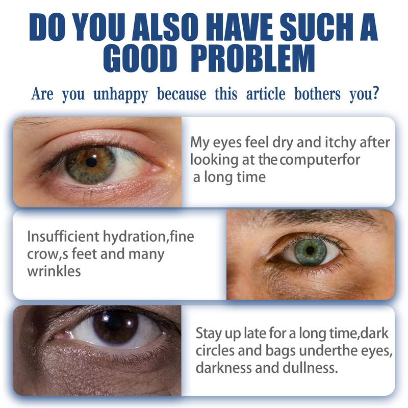 East Moon Men's Retinol Eye Cream, Firming And Lightening Eye Bags, Moisturizing And Repairing Eye Cream_voghion.com