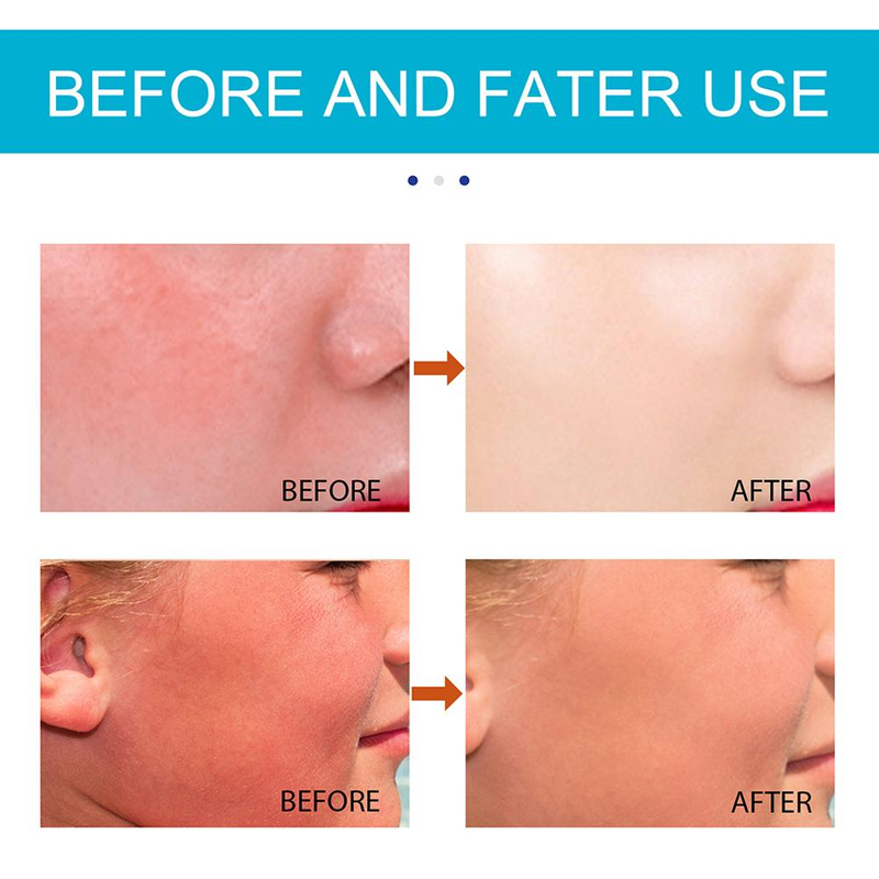 Sauļošanās krēms SP50+ Isolation Sunblock Stick Body Whitening Protector Cream Saules aizsargkrēms UV Korektors Mitrinošs S_voghion.com