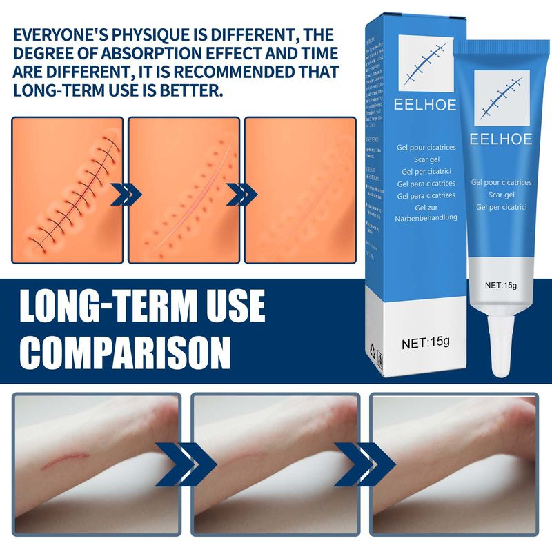 EELHOE gel repair type softening and smoothing scar moisturizing skin damage topical cold compress_voghion.com