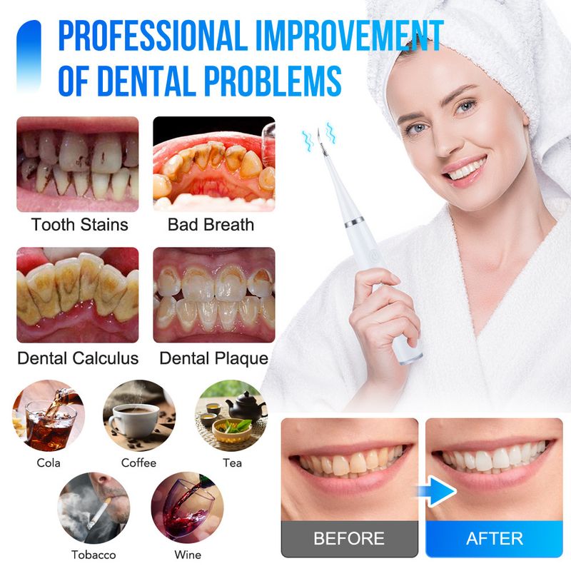 Elektrisk ultralyds-tandrenser Tandstensfjerner Rengøring Whitening Scaler Dental Calculus Remover Udskiftelig tandbørste_voghion.com