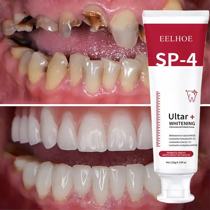 EELHOE Protect Gum Fresh Breath Tandrengöring Rösta Reparation Tandblekning Sp 4 Probiotisk kariestandkräm_voghion.com