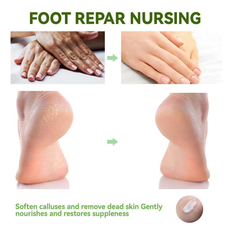 EELHOE Urea Hand and Foot Cream Nawilżający, przeciw wysuszaniu, nawilżający, regenerujący, wielofunkcyjny krem do rąk i stóp_voghion.com
