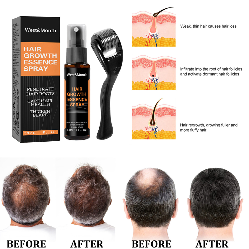 West&Month Polygonum multiflorum anti dropping hair Hair ginger spray thick hairline care solution_voghion.com