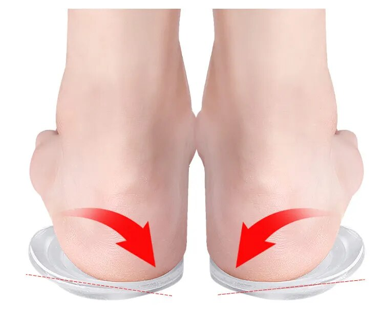 Jaunas Papēžu zolītes Vīriešu Sieviešu Apavu Ieliktņi Spilvens X-Type O-Type Kāja Ortopēdiskais Pad Pēda Varus Valgus Korektors_voghion.com