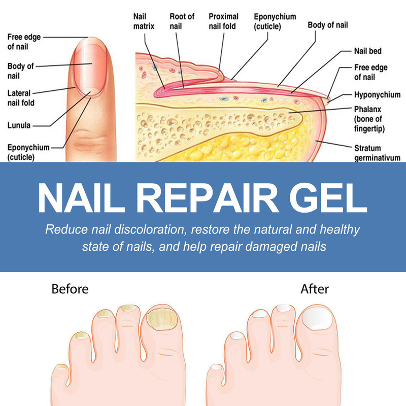 OUHOE gel per la riparazione delle unghie con smalto morbido e ispessente per mani e piedi_voghion.com