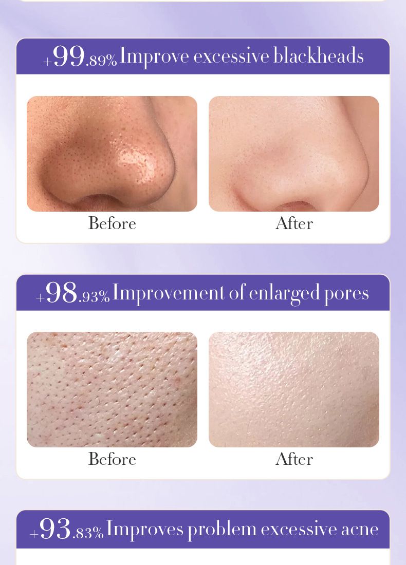 Mascarilla SADOER Starry Sky Whitening Cleansing Tear Mask, Elimina eficazmente los puntos negros, hidrata y rejuvenece, calma y repara la tirantez._voghion.com