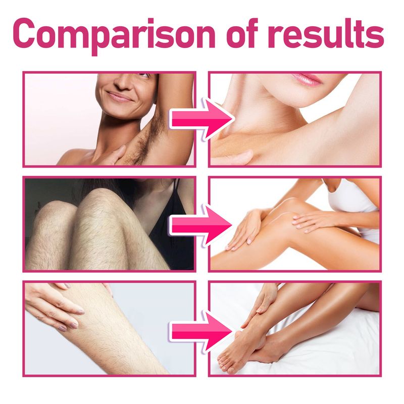 Oce Aura Women's Hair Removal Cream for whole body underarm removal, gentle non irritating, cleansing and moisturizing_voghion.com