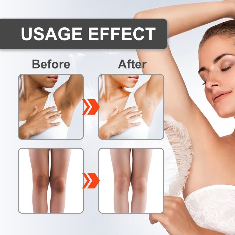 OUHOE Cream Repairs Underarm Elbow Joint Blackness, Brightens Skin Tone, Moisturizes Whitening and_voghion.com