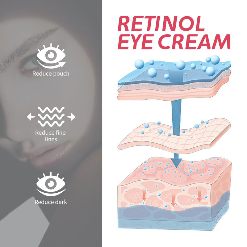 La crema con retinol Eye Beautiful levanta y tensa las líneas finas alrededor de los ojos, las líneas de cola de gallo y los círculos negros debajo de los ojos._voghion.com