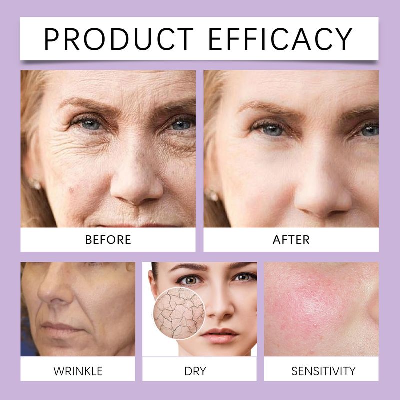 Hoygi Facial Moisturizer Moisturizes, Moisturizes, Nourishes, Brighens, And Restores Dry Skin To Keep It Hydrated_voghion.com