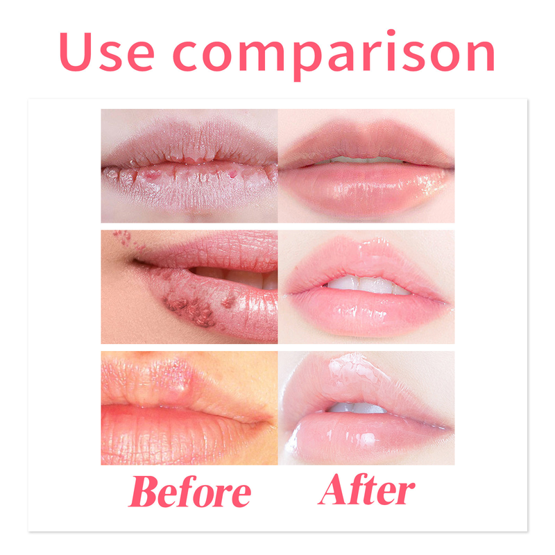 Care Beautiful Lip Oil Moisturizes, Moisturizes, Repairs Lip Dead Skin, Prevents Dry Cracks, and Gently Care Lip Oil_voghion.com
