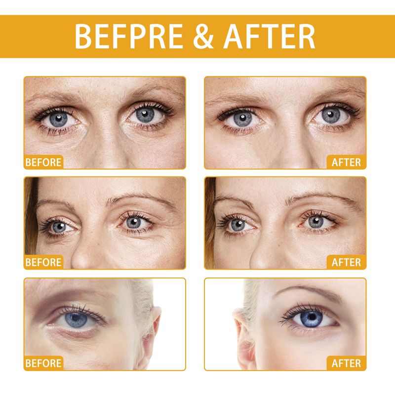 EELHOE Rice Serum Eye Cre Reduces Dark Circles, Bags, Wrinkles, Care For The Area, Moisturize And Anti Wrinkle Eye_voghion.com