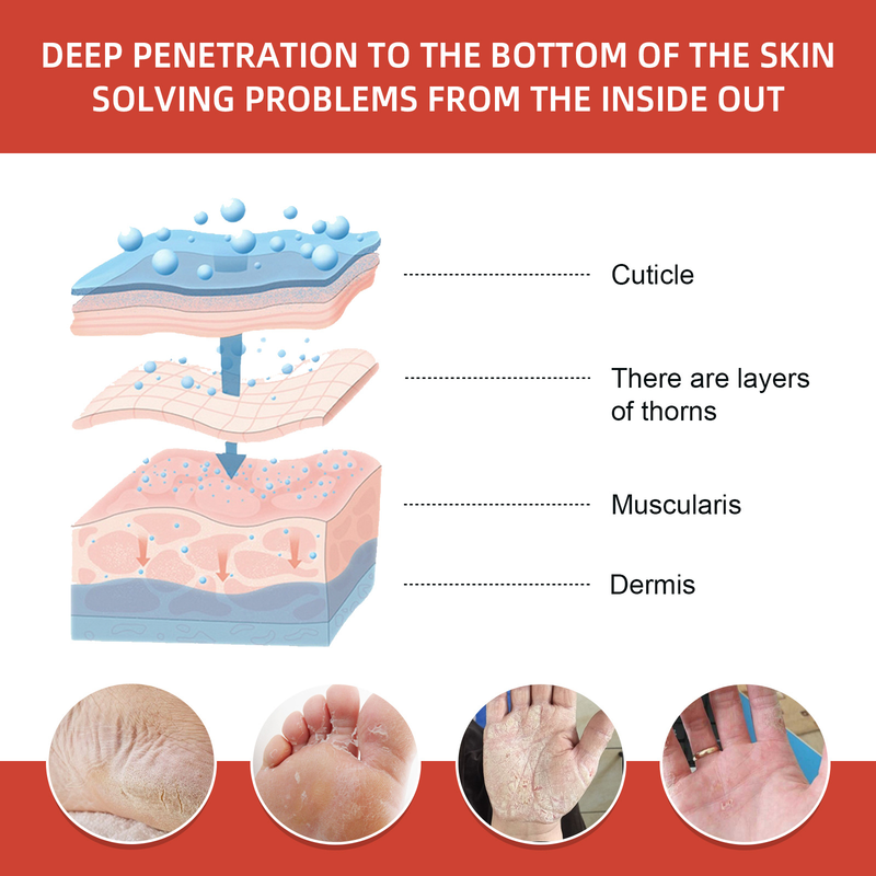 Moon South Heel Repair Cream Fußpeeling, Peeling, Anti-Trockenrissigkeit, Cocoon und Soft Foot Protection Cre_voghion.com