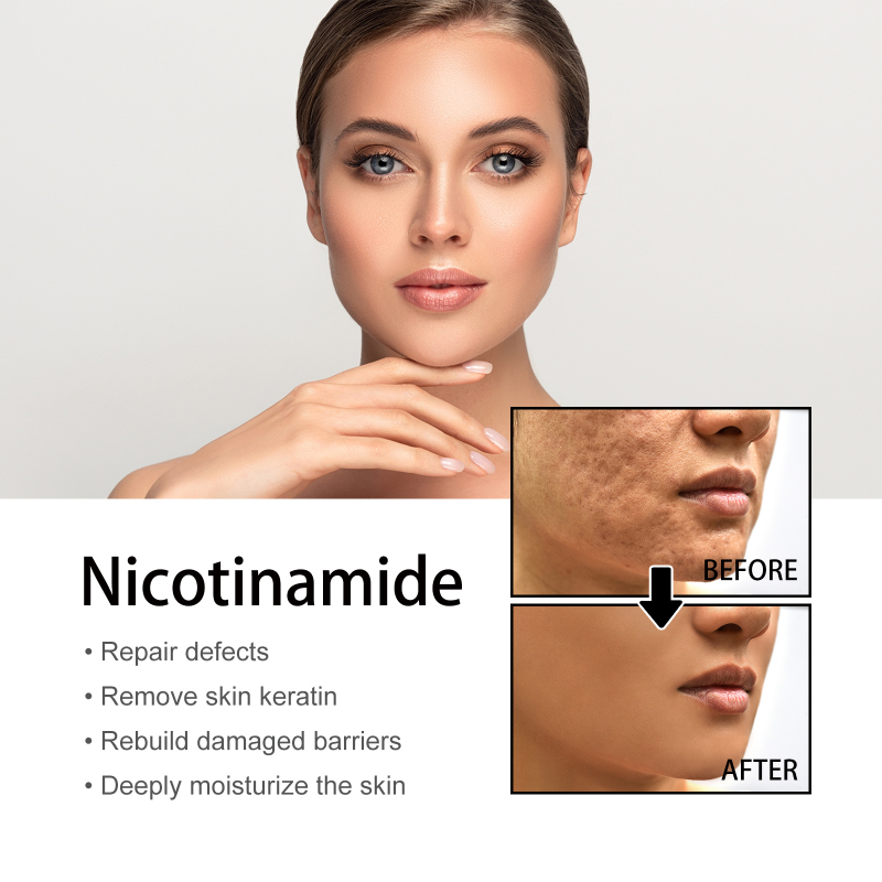 Serum Effective Nicotinamide Whitening Essence Remove Dark Spots Freckle Fade Pigmentation Melasma Correction Brigh_voghion.com