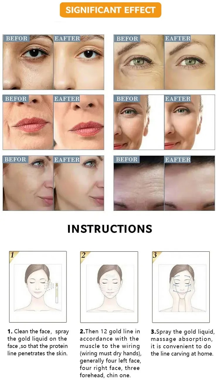 Collagen Thread azonnali lifting ránctalanító oldható fehérjeszálak szérumkészlet felszívódó arcfeltöltő öregedésgátló bőr_voghion.com