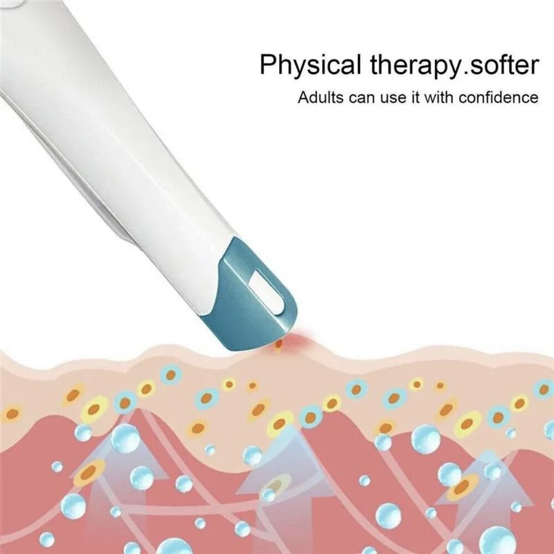 New Portable Physical Pen For Adults And Children Mosquito Bite Relief Device_voghion.com