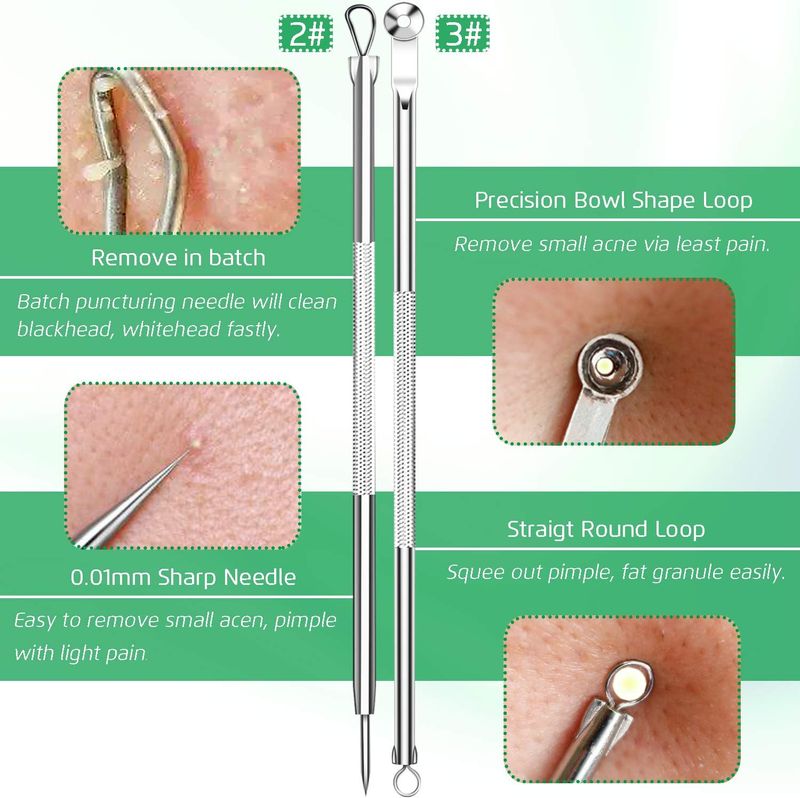 5 estrattori di comedoni, kit di pinzette curve per punti neri, kit di strumenti professionali in acciaio inossidabile per la rimozione dell'acne_voghion.com