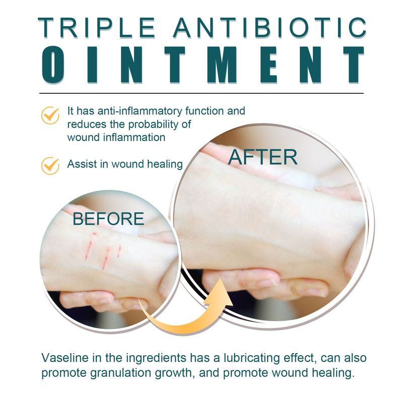 Ximonth Repair Relieving Scratches And Traumas, Fading Scars, Moisturizing Skin Care Cream_voghion.com