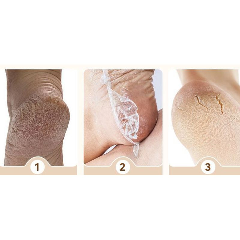 New File Multi-Functional Electric Foot Remover Fully Automatic Dead Skin Callus Grinder Nail Salon_voghion.com