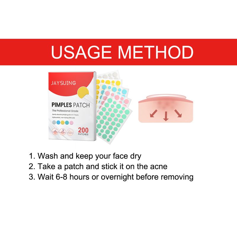 Gekleurde acne-stickers, gezichtsacne-herstellende reinigingsstickers voor de huid_voghion.com