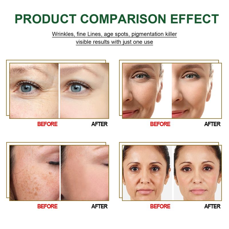 Facial Essence Oil Whitening Remove Wrinkle Promote Cell Regeneration Lift and Tighten Skin Intensive Age-defying Serum_voghion.com