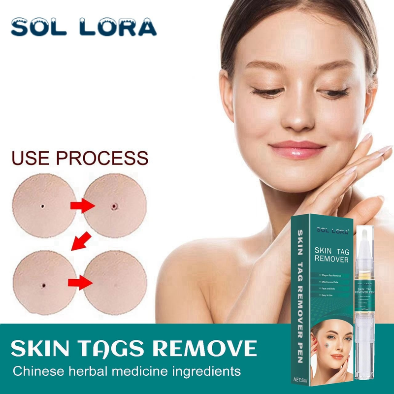 SOL LORA Pen Cream flat specially sharp Ke warts, You Ping Liquid for removing warts_voghion.com