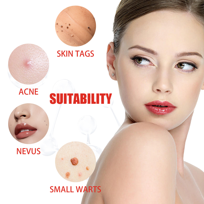 Removing Beautiful Verruca Set Skin Repair and Nevus Removing Patch Chicken Eyes, Barbs, Warts, Meat Granules Smooth B_voghion.com