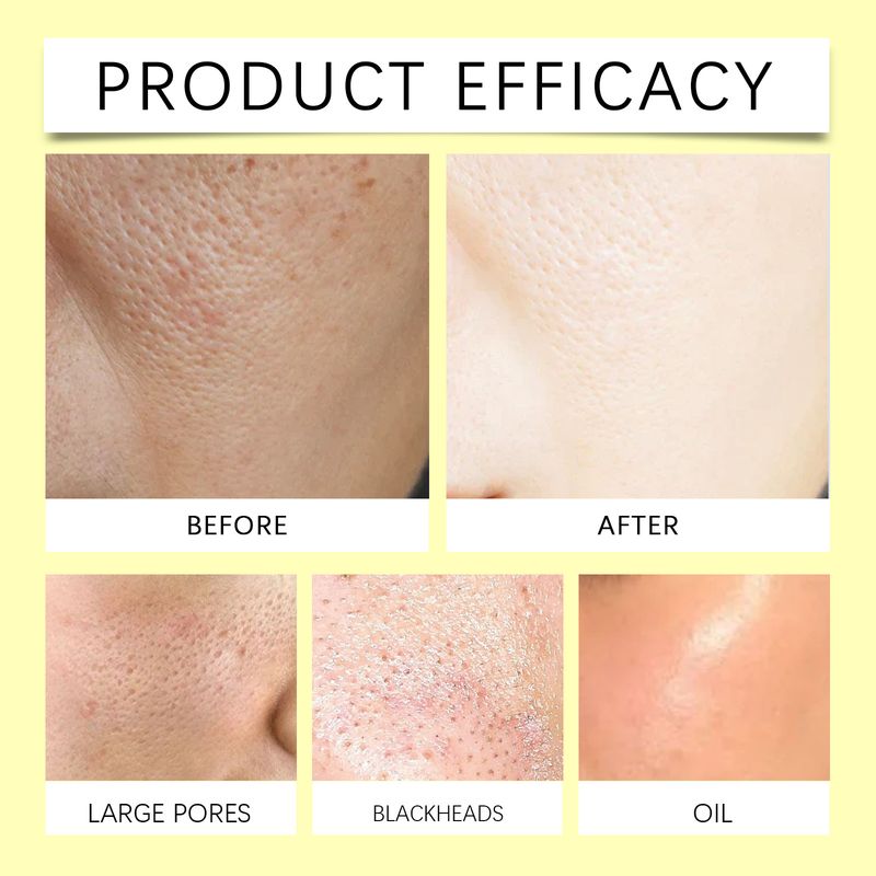 HOYGI Το κουρκουμάς και το κοχικό οξύ καταπραΰνουν, αναζωογονούν, καθαρίζουν τους πόρους, ενυδατώνουν και θρέφουν το δέρμα. Σφουγγάρι καθαρισμού δέρματος_voghion.com