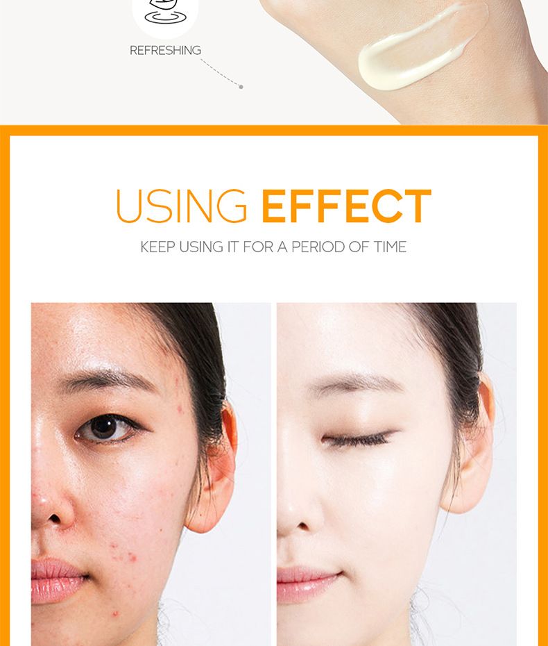FENYI Fenyi Vitamine C Essence Cream 40g Hydraterende Hydraterende Crème Gezichtscrème Huidverzorging_voghion.com