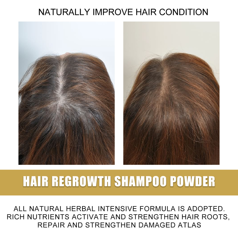 EELHOE Ingwer-Shampoo beugt Haarausfall vor, fördert das Wachstum, reinigt, kontrolliert Öl, spendet Feuchtigkeit und pflegt dichtes Haar_voghion.com