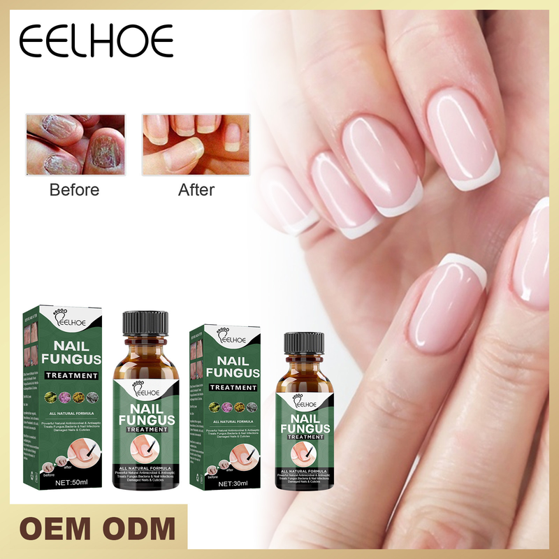 Grey Nail Beautiful Repair Thickening, Brightening, Soft Nail , Foot Care , Grey Nail Enhancement_voghion.com
