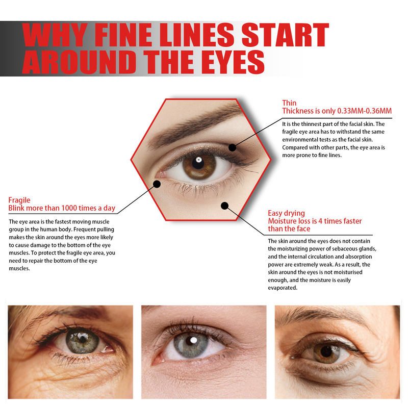 Eye Serum for Dark Circle and Wrinkles Bags Removal Lifting Firming Essence Anti Puffiness Reduce Fine Lines Eye Skin Care_voghion.com