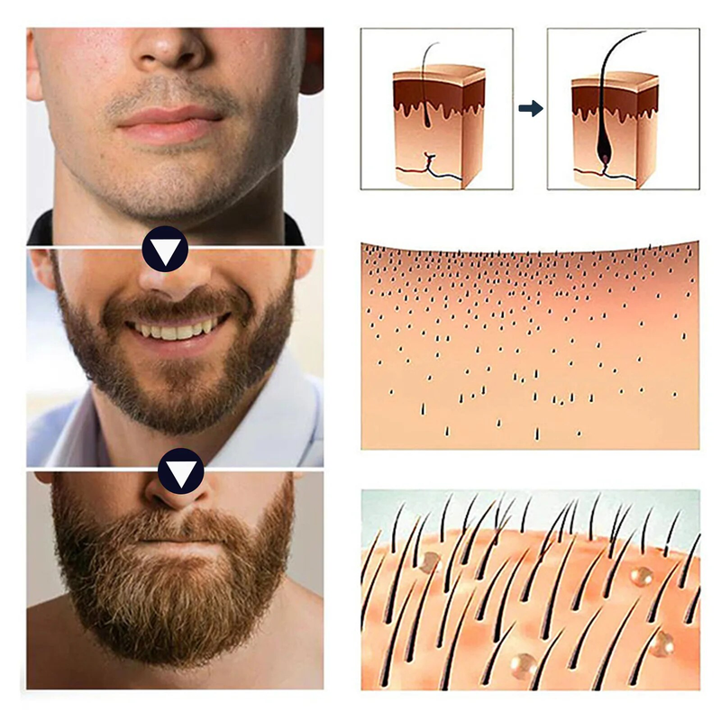 Siero per la crescita dei capelli Anti perdita di capelli Addensare Idratante Trattamento del cuoio capelluto Barba Follicoli piliferi Riparazione nutriente Radice dei capelli Cura dello zenzero_voghion.com