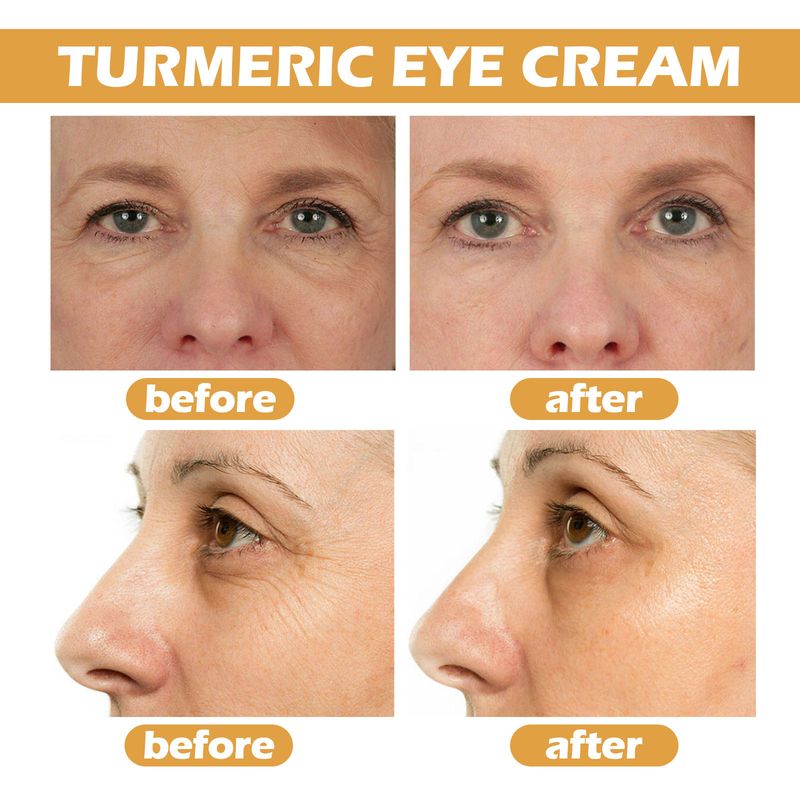 Turmeric Whitening Instant Wrinkle Remover Anti Dark Circle Fade Fine Line Brighten Moisturizer Eye Care Cream_voghion.com
