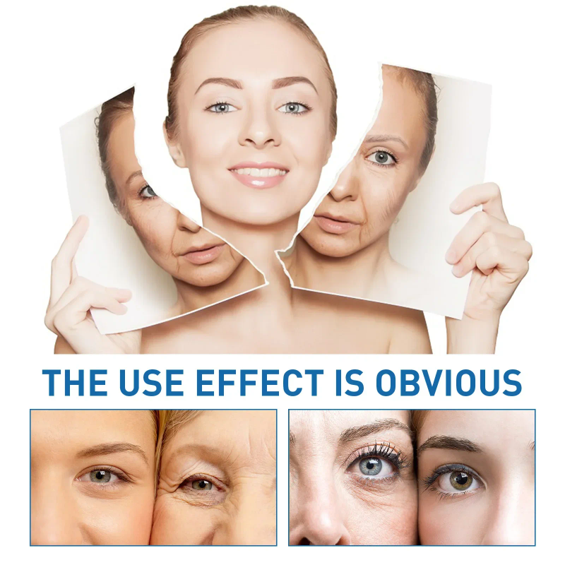 cream, anti-aging Anti-wrinkle essence, facial firming and whitening, dark circle removal, fine lines reductio_voghion.com
