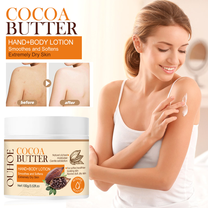 Aufhellende Körperlotion, entfernt Melanin, hellt dunkle Flecken auf, Anti-Aging, glättet, macht weich, spendet Feuchtigkeit, erhellt die Haut, Kakaobuttercreme_voghion.com