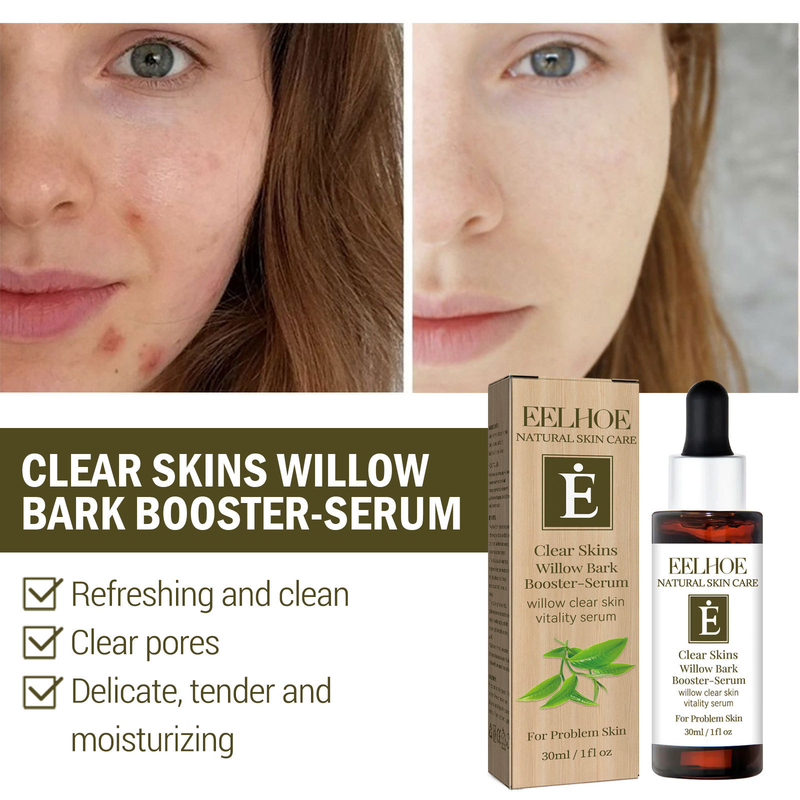 EELHOE Cleansing Willow Bark-essentie kan de droogheid verlichten, acnevlekken vervagen, de huid reinigen, hydrateren en een gevoelige huid veroorzaken_voghion.com
