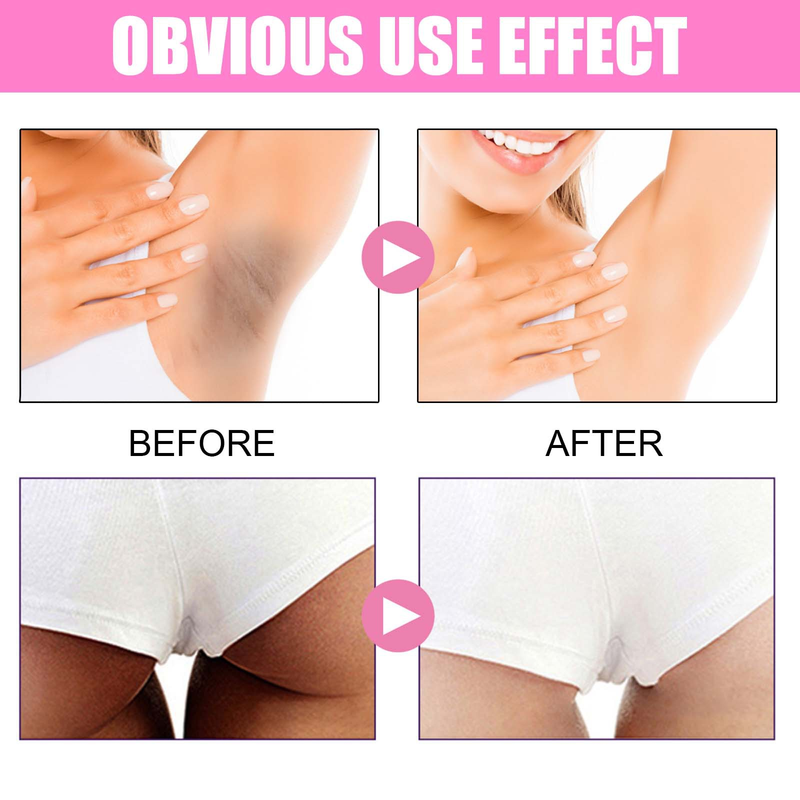 2023 24ss hot Armpit Brightening essence Cream Repairs Black Acne Lightens Melanin, Softens Skin, Moisturizes and W_voghion.com