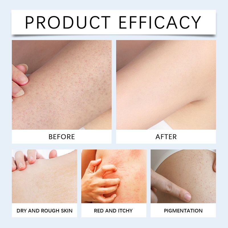OceAura Niacinamide Soap Gently Cleans And Moisturizes Skin, Brightening, Silky, And Refreshing Body Soap_voghion.com