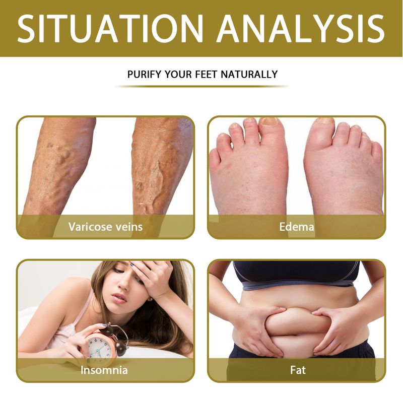 South Moon Bee Venom Gel Leg Care Foot Bath Bag_voghion.com