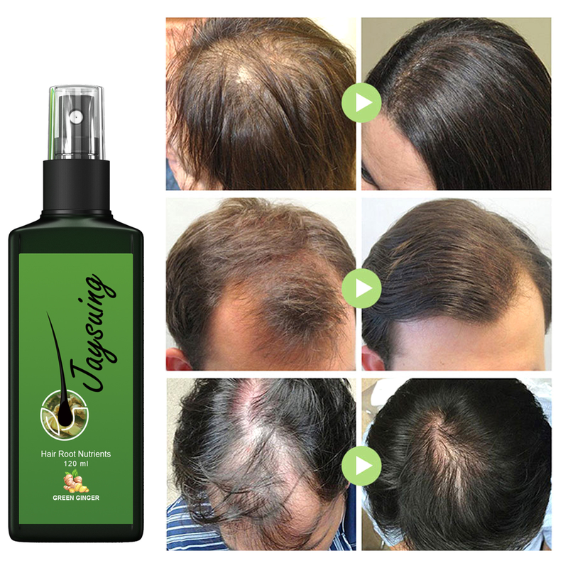 Jaysuing Lozione nutriente per massaggio del cuoio capelluto denso, nutriente, forte e resistente, per la crescita delle radici dei capelli_voghion.com