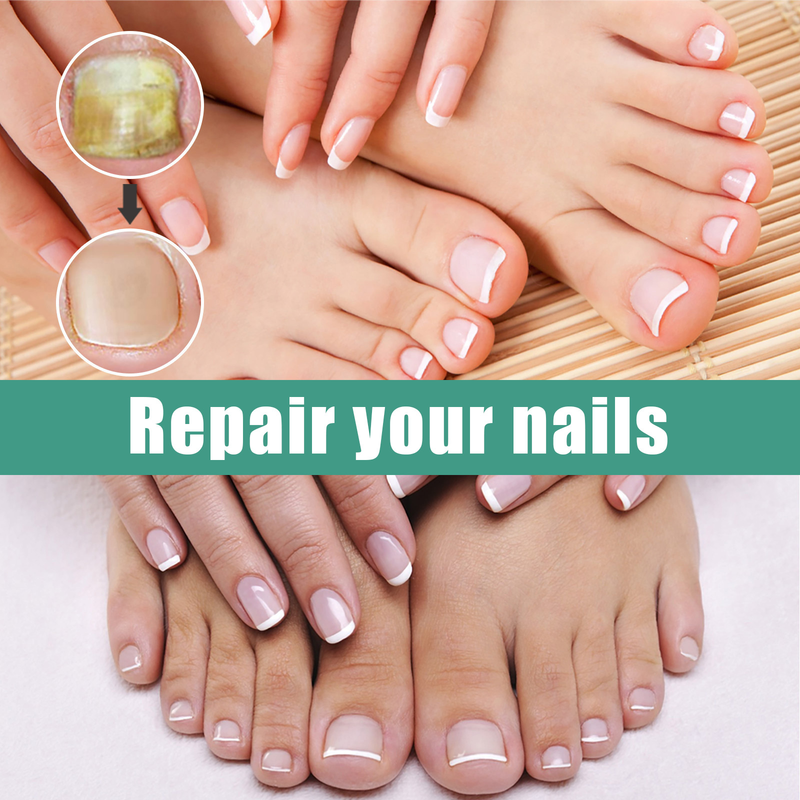 EELHOE Grey Repair Hand Foot Soft Deodorant Nail Care Liquid, Ενισχυτικό για Πύκνωση και Λάμψη των Νυχιών_voghion.com