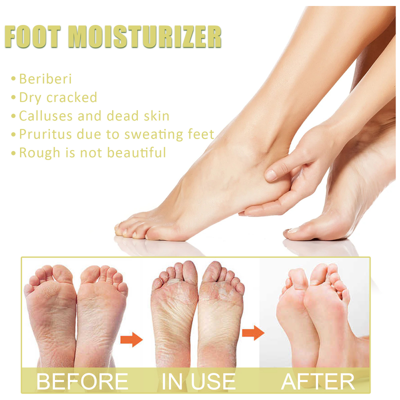 Care Beautiful fotspray fotvårdsvätska återfuktande deodorantspray exfolierande, peeling och motverkar sprickor_voghion.com