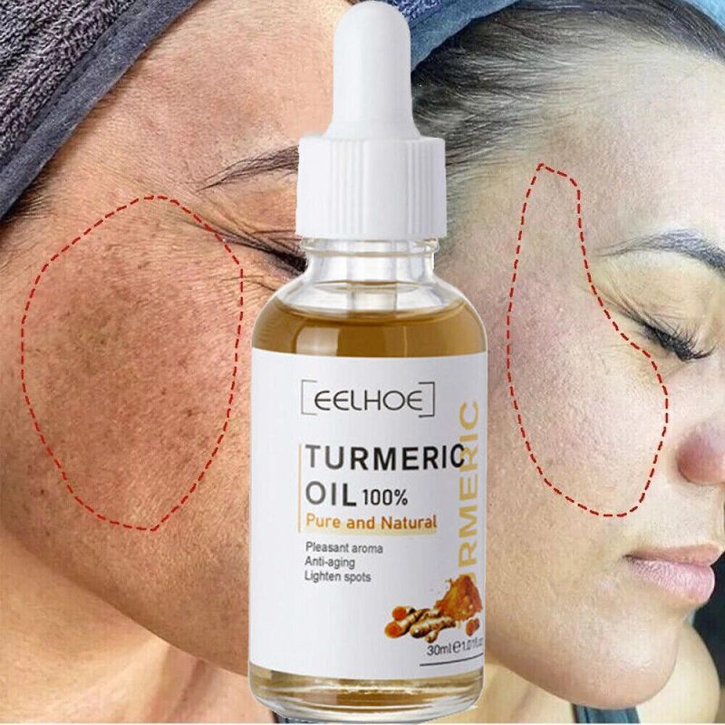 2x Turmeric Cream Dark Spot Corrector Skin Melasma Remove Wrinkles Serum Anti-spot 30ml_voghion.com