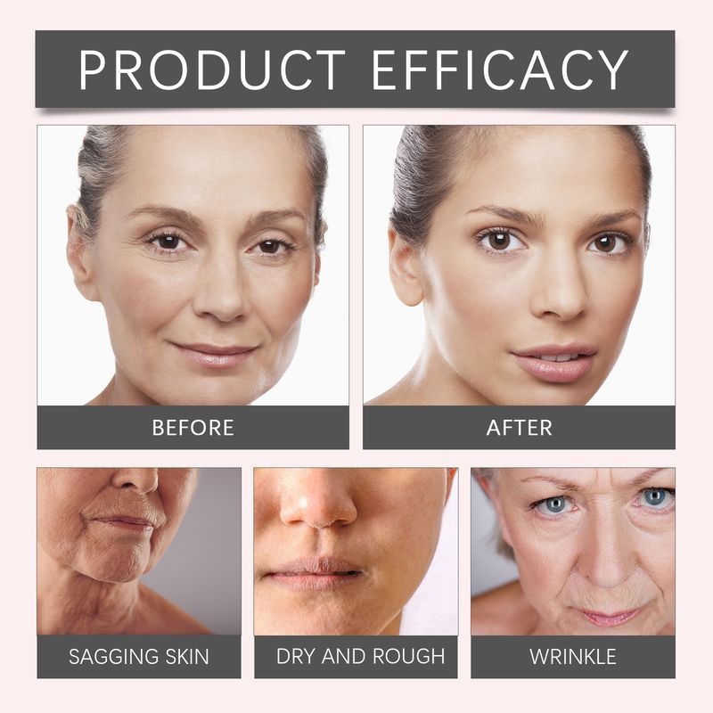 Κρέμα κολλαγόνου-ζελέ καθαρίζει απαλά τους πόρους του προσώπου Ενυδατική και λαμπρυντική μάσκα-τζελ κρέμα_voghion.com